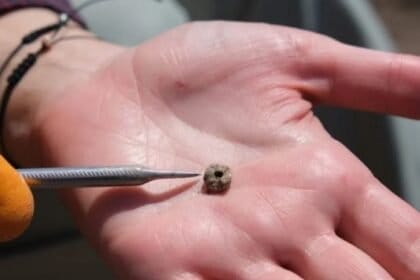 Essa é o piercing mais antigo do mundo e tem mais de 11 mil anos