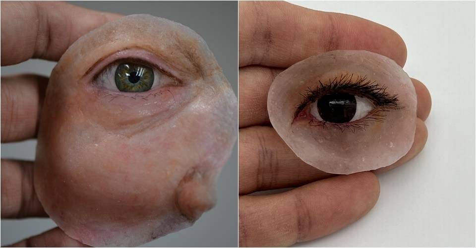 Instituto oferece reabilitação facial gratuita com prótese de tecnologia 3D