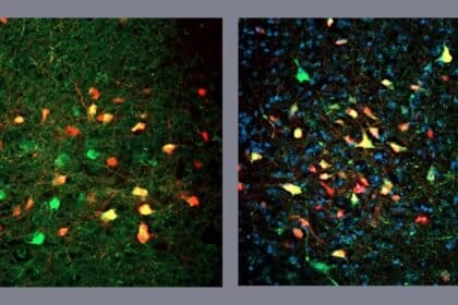 Descoberta de neurônios que motivam a busca obsessiva por alimentos, mesmo sem fome