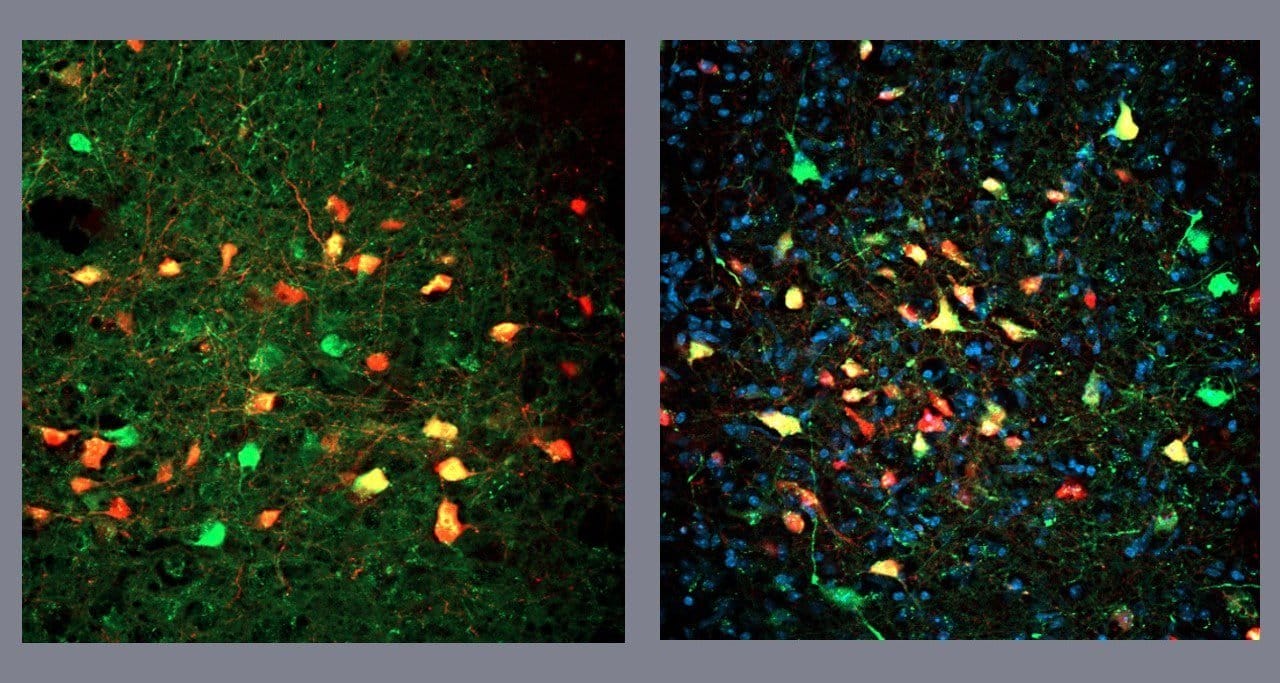 Descoberta de neurônios que motivam a busca obsessiva por alimentos, mesmo sem fome