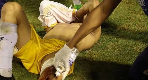 PM de Goiás atira em goleiro em confusão durante jogo de futebol